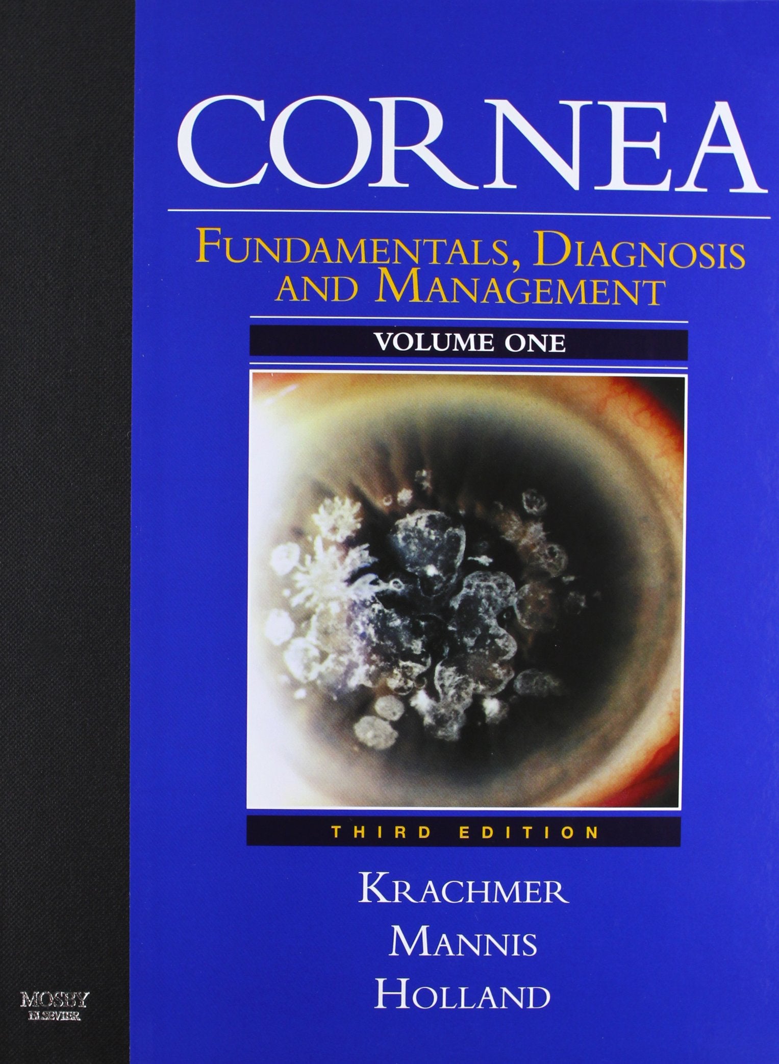 Cornea: Fundamentals, Diagnosis and Management; Surgery of the Cornea and Conjunctiva book