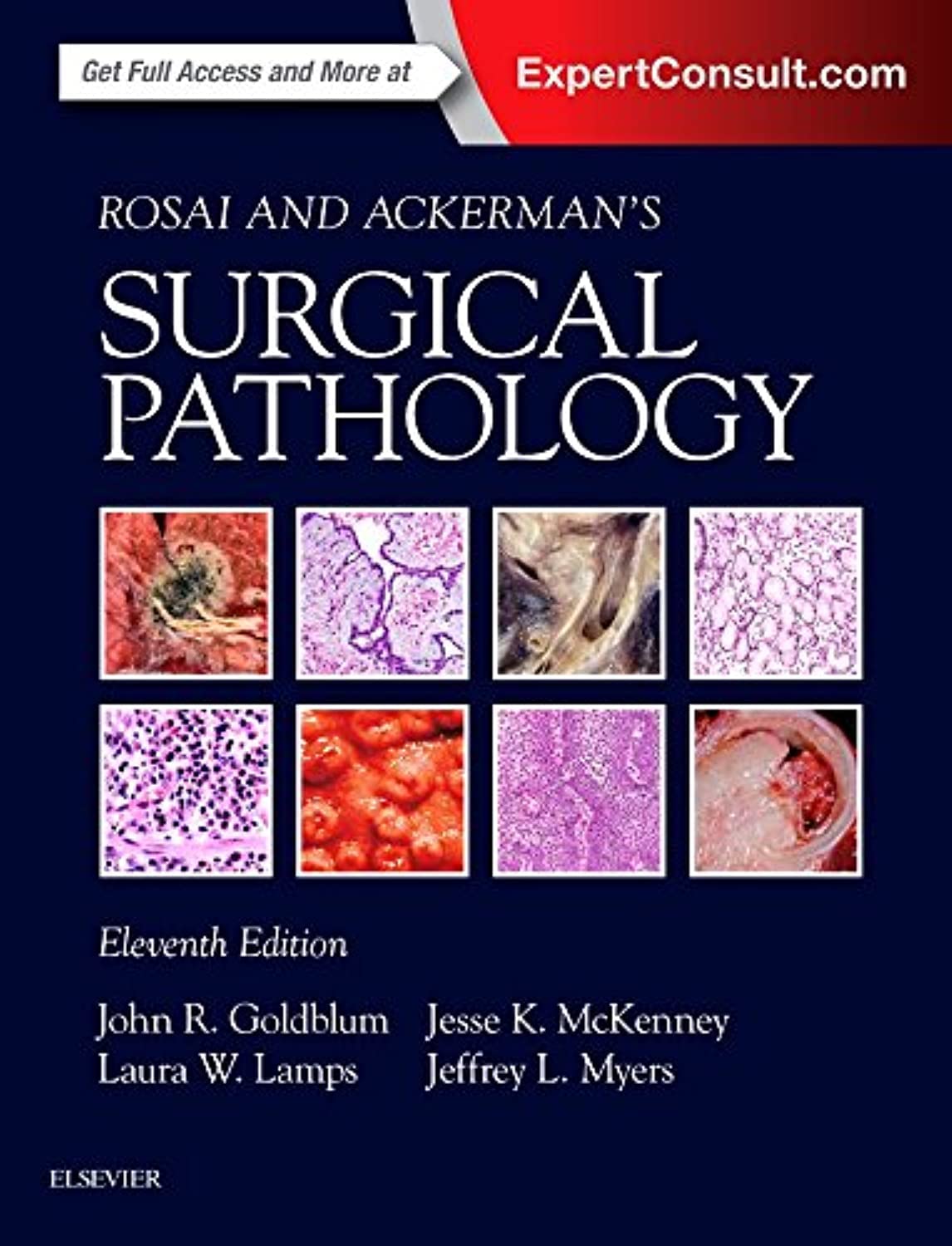 Rosai and Ackerman's Surgical Pathology - 2 Volume Set Medicine