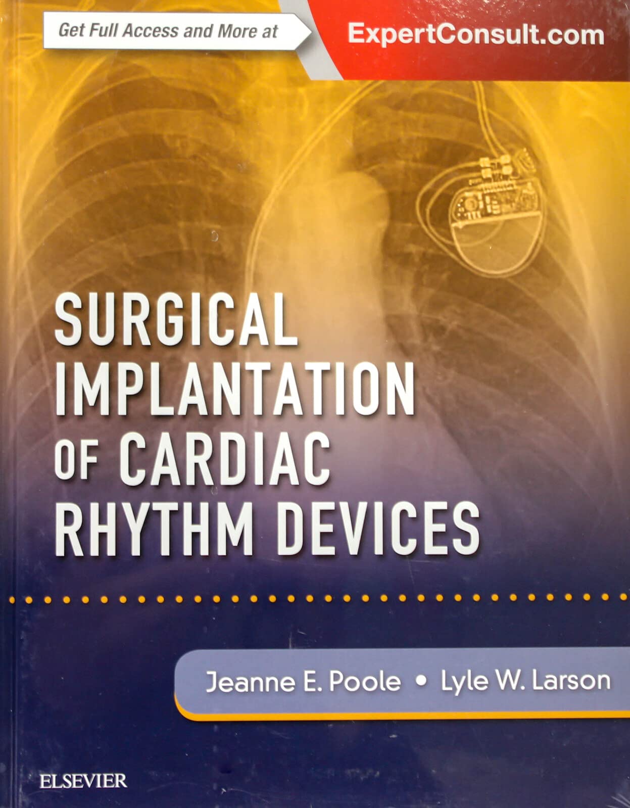 Surgical Implantation of Cardiac Rhythm Devices Medicine