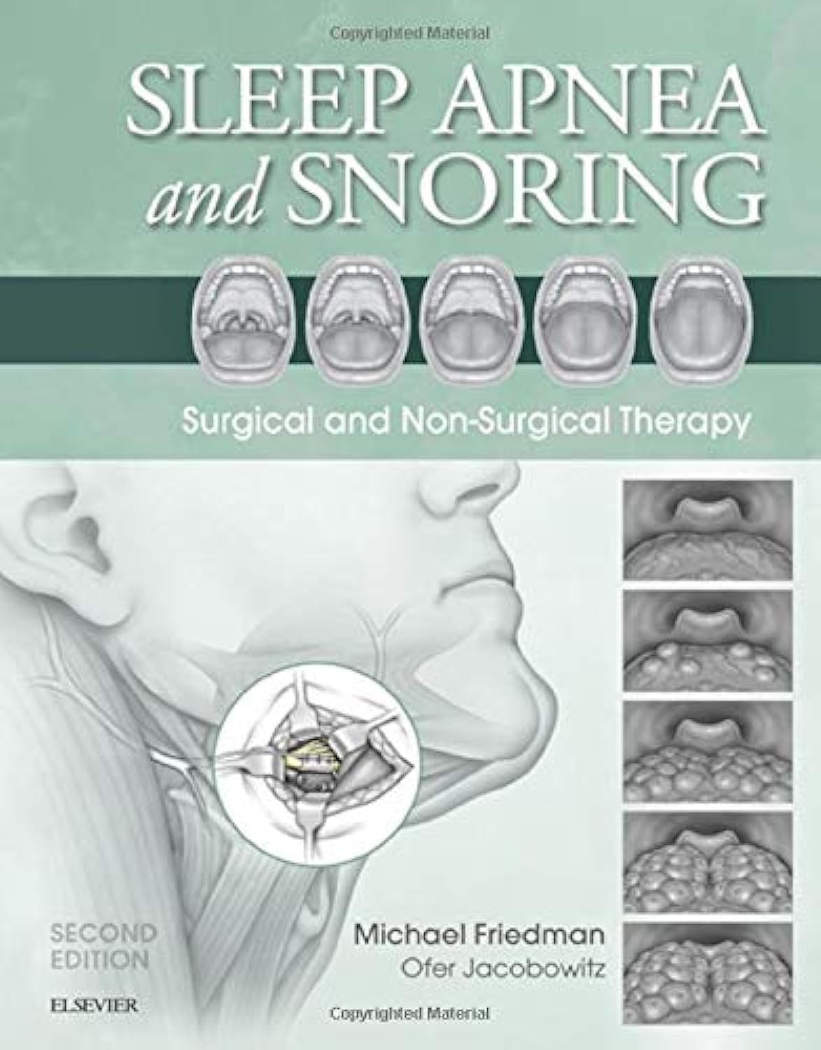 Sleep Apnea and Snoring: Surgical and Non-Surgical Therapy Medicine