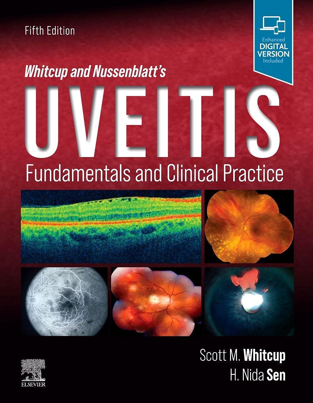 Whitcup and Nussenblatt's Uveitis: Fundamentals and Clinical Practice Medicine