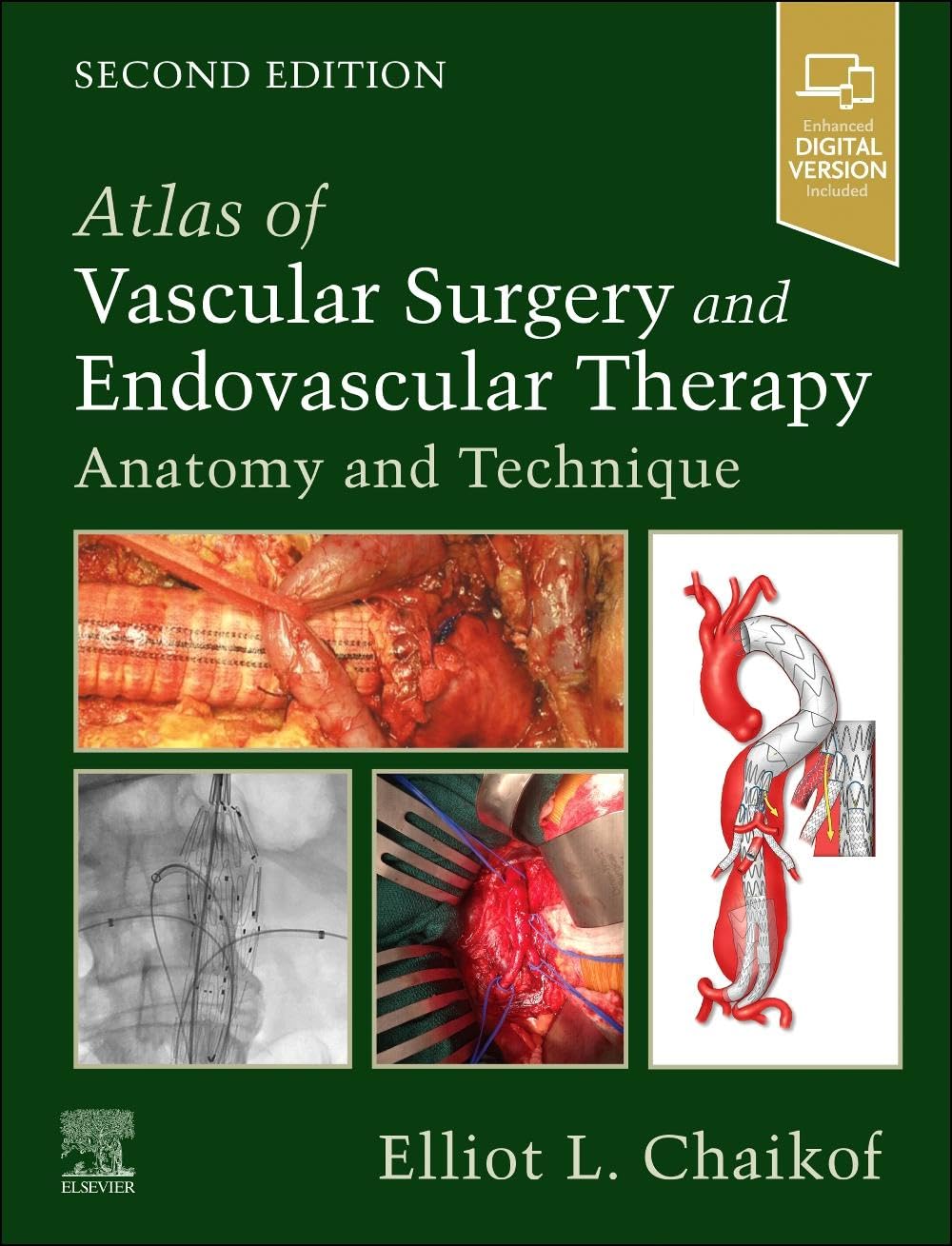 Atlas of Vascular Surgery and Endovascular Therapy Medicine