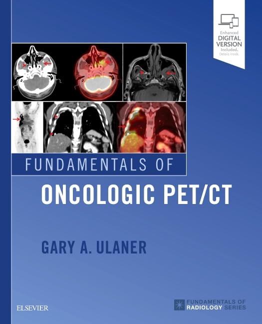 Fundamentals of Oncologic PET/CT (Fundamentals of Radiology) Medicine