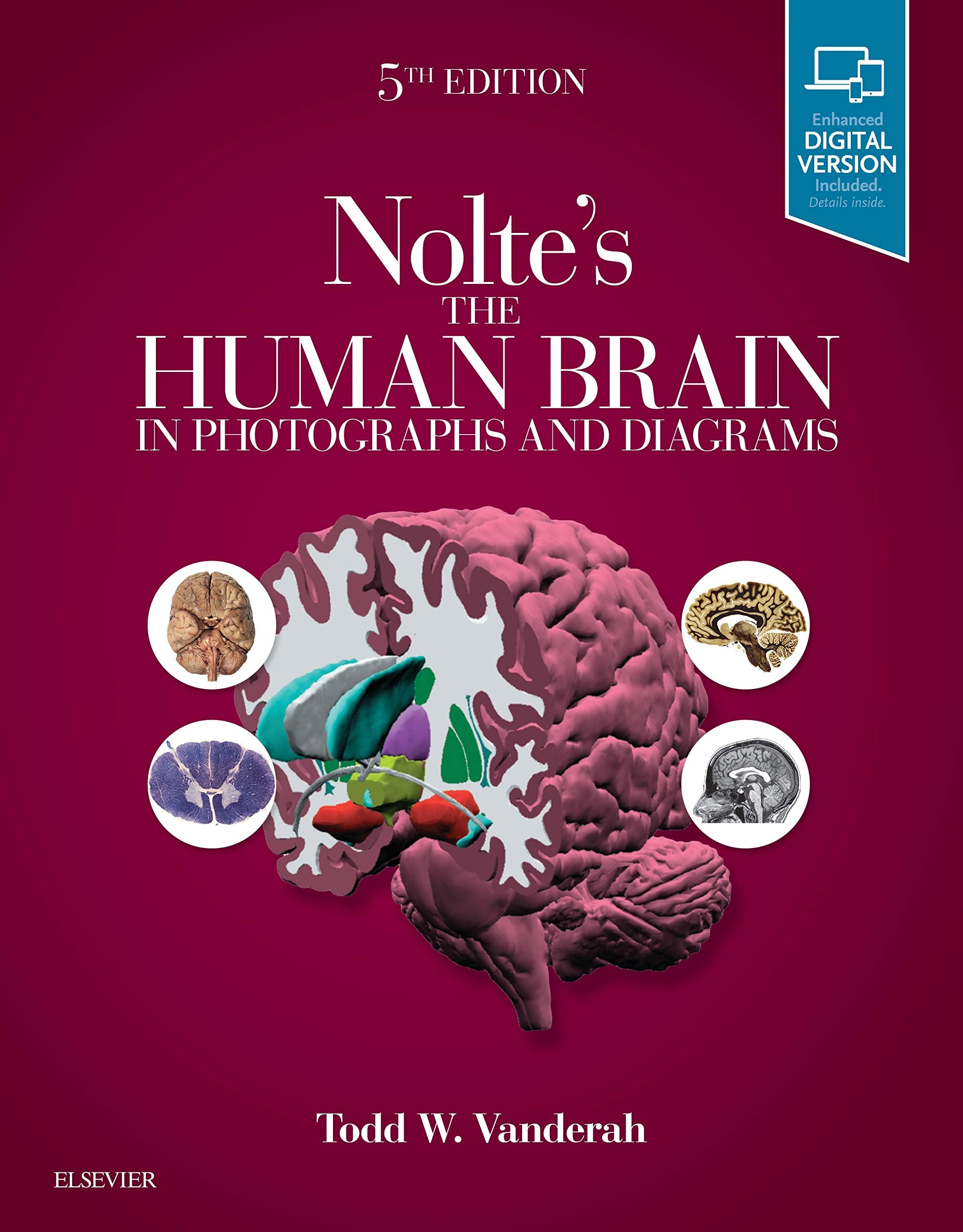 Nolte's The Human Brain in Photographs and Diagrams: With STUDENT CONSULT Online Access Medicine