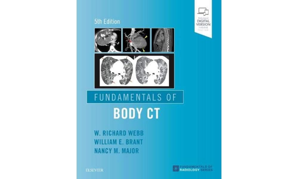 Fundamentals of Body CT (Fundamentals of Radiology) Medicine