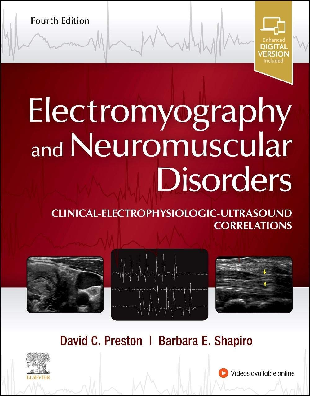 Electromyography and Neuromuscular Disorders: Clinical-Electrophysiologic-Ultrasound Correlations Medicine