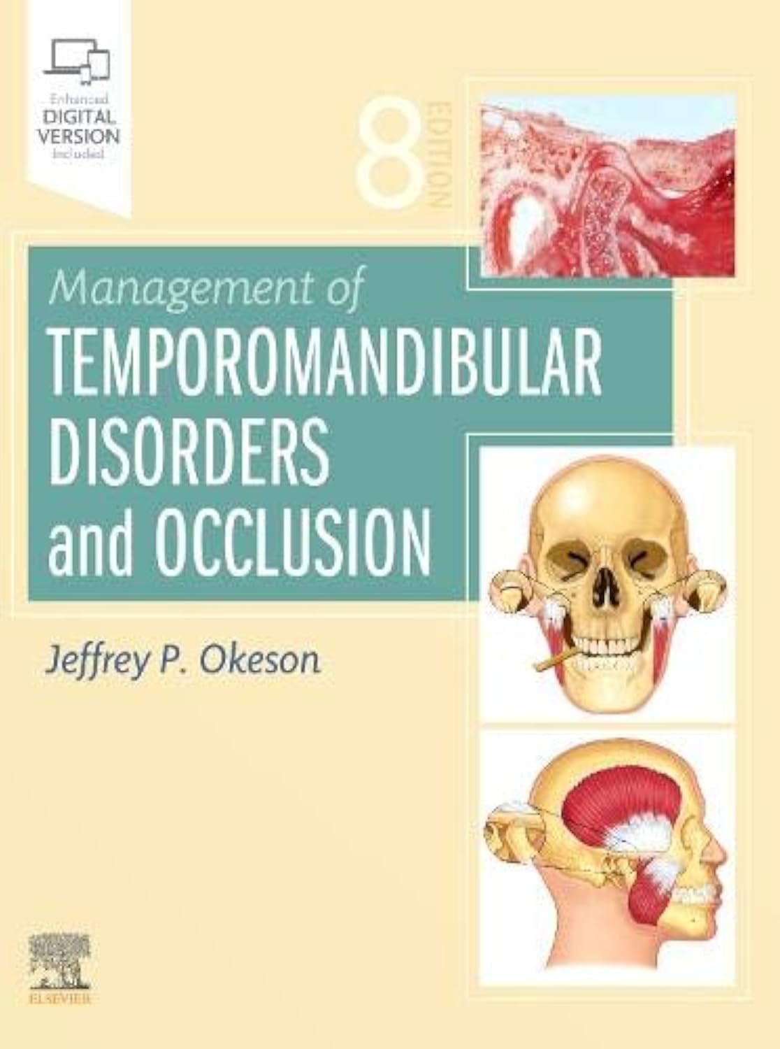 Management of Temporomandibular Disorders and Occlusion Medicine