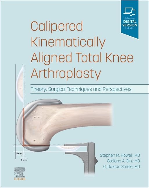 Calipered Kinematically aligned Total Knee Arthroplasty: Theory, Surgical Techniques and Perspectives Medicine