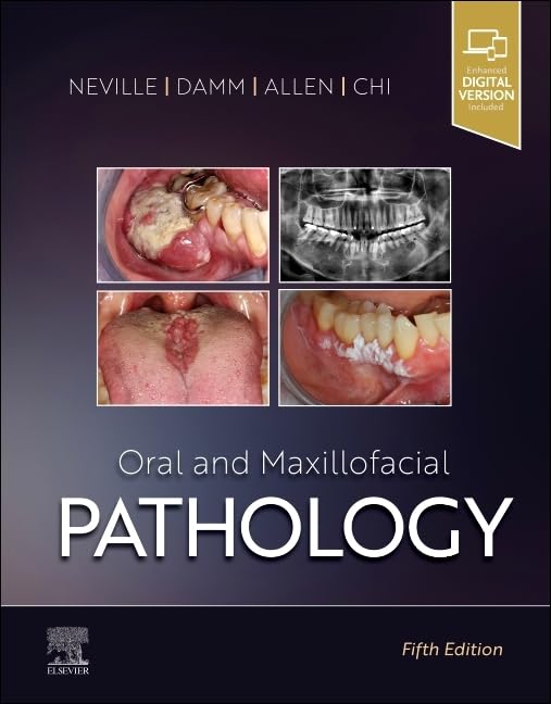 Oral and Maxillofacial Pathology Medicine
