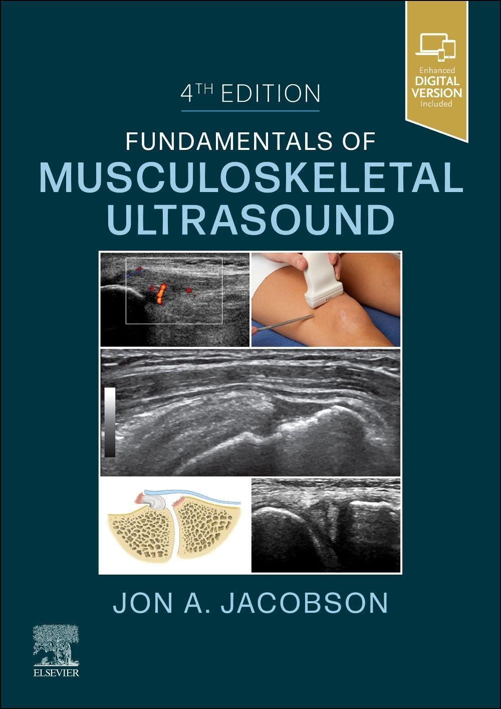 Fundamentals of Musculoskeletal Ultrasound Medicine