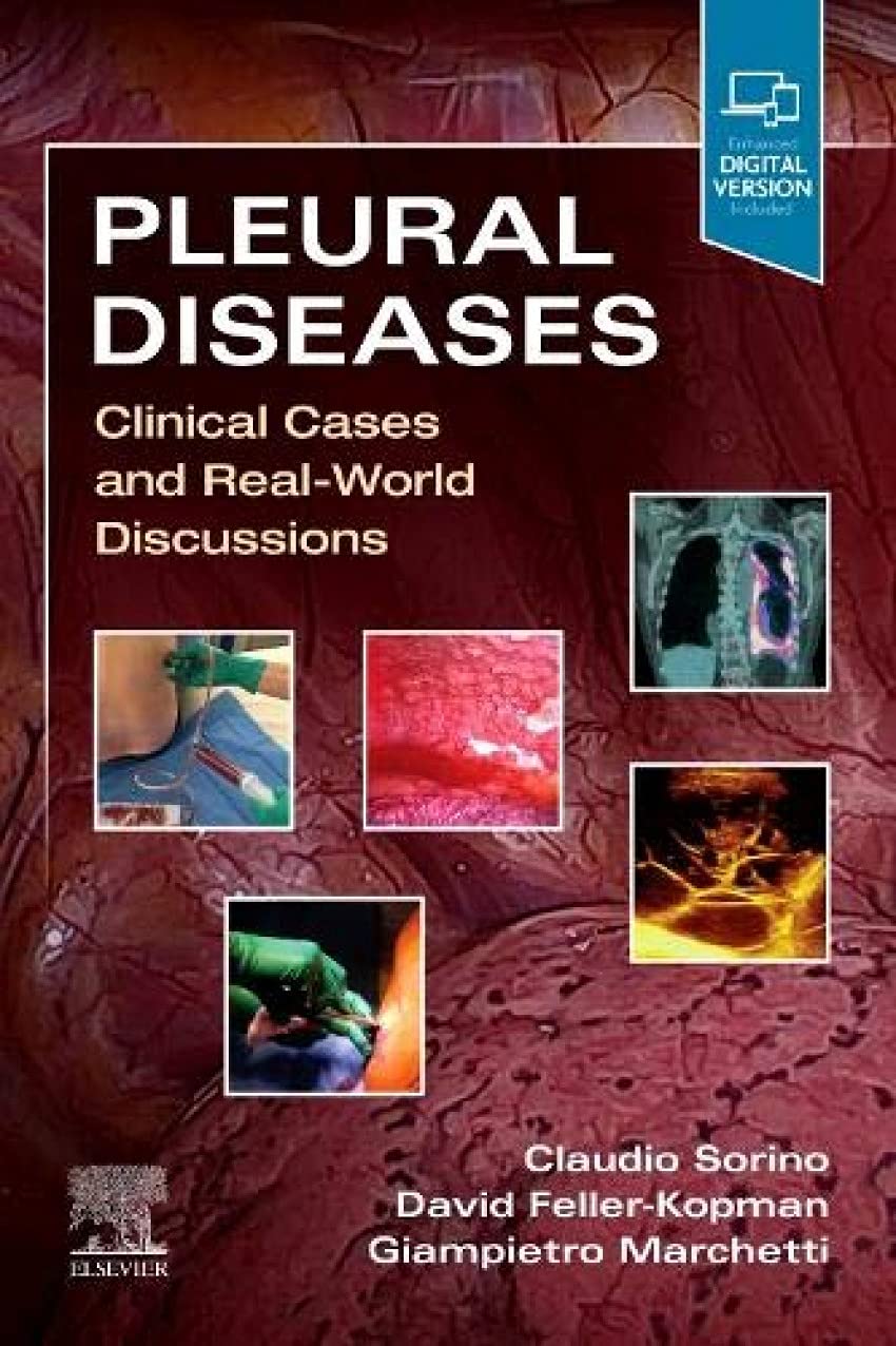 Pleural Diseases: Clinical Cases and Real-World Discussions Medicine