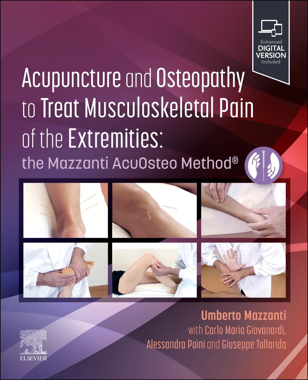 Acupuncture and Osteopathy to Treat Musculoskeletal Pain of the Extremities Medicine