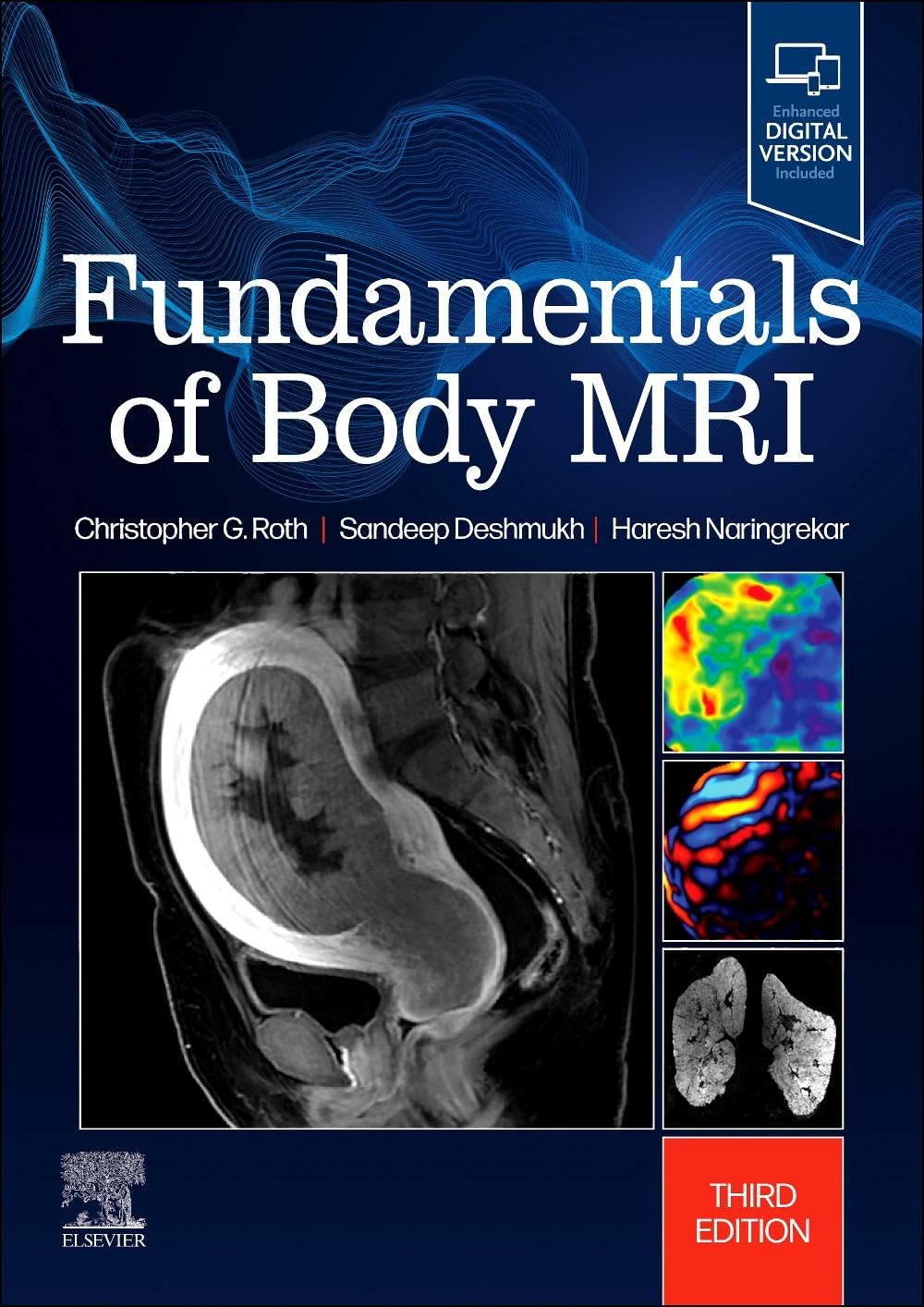 Fundamentals of Body MRI (Fundamentals of Radiology) Medicine