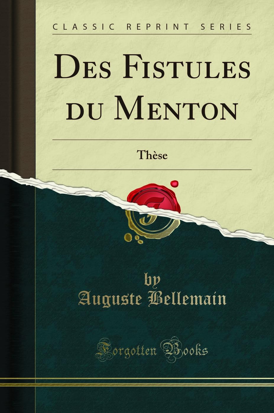 Des Fistules Du Menton: Thèse (Classic Reprint) book