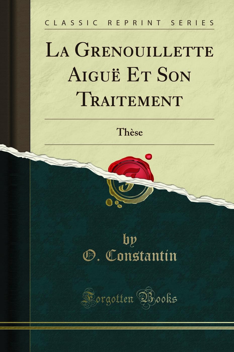 La Grenouillette Aiguë Et Son Traitement: Thèse (Classic Reprint) book