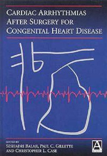 Cardiac Arrythmias After Surgery for Congenital Heart Disease Medicine