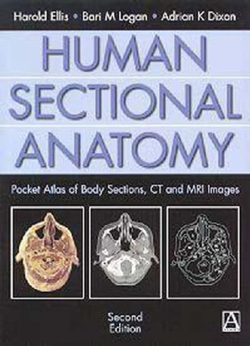 Human Sectional Anatomy: Pocket Atlas of Body Sections, Ct and Mri Images (An Arnold Publication) Medicine