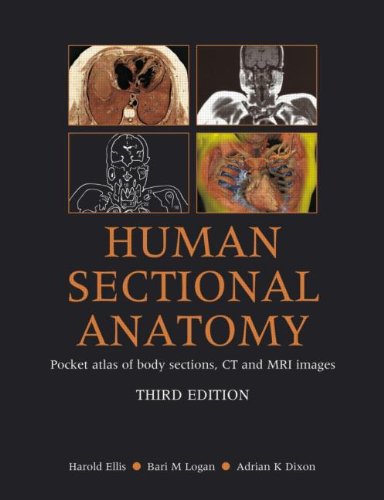 Human Sectional Anatomy: Pocket Atlas of Body Sections, CT and MRI Images Medicine