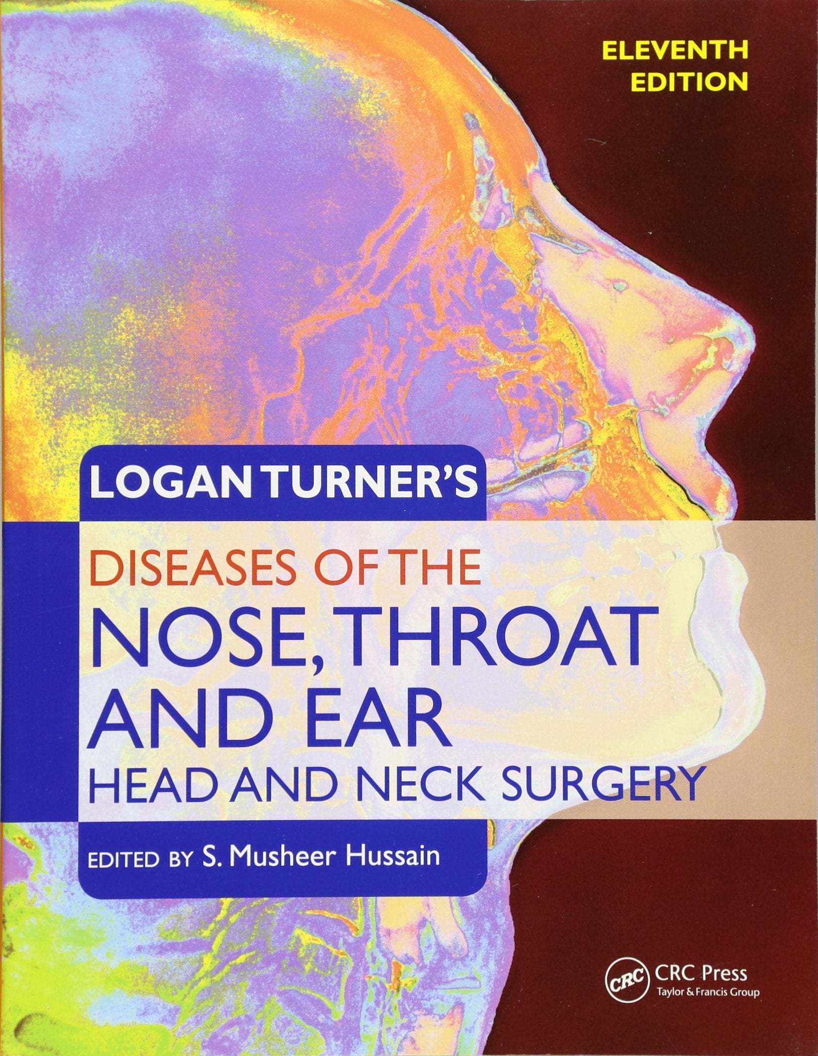 Logan Turner's Diseases of the Nose, Throat and Ear, Head and Neck Surgery Medicine