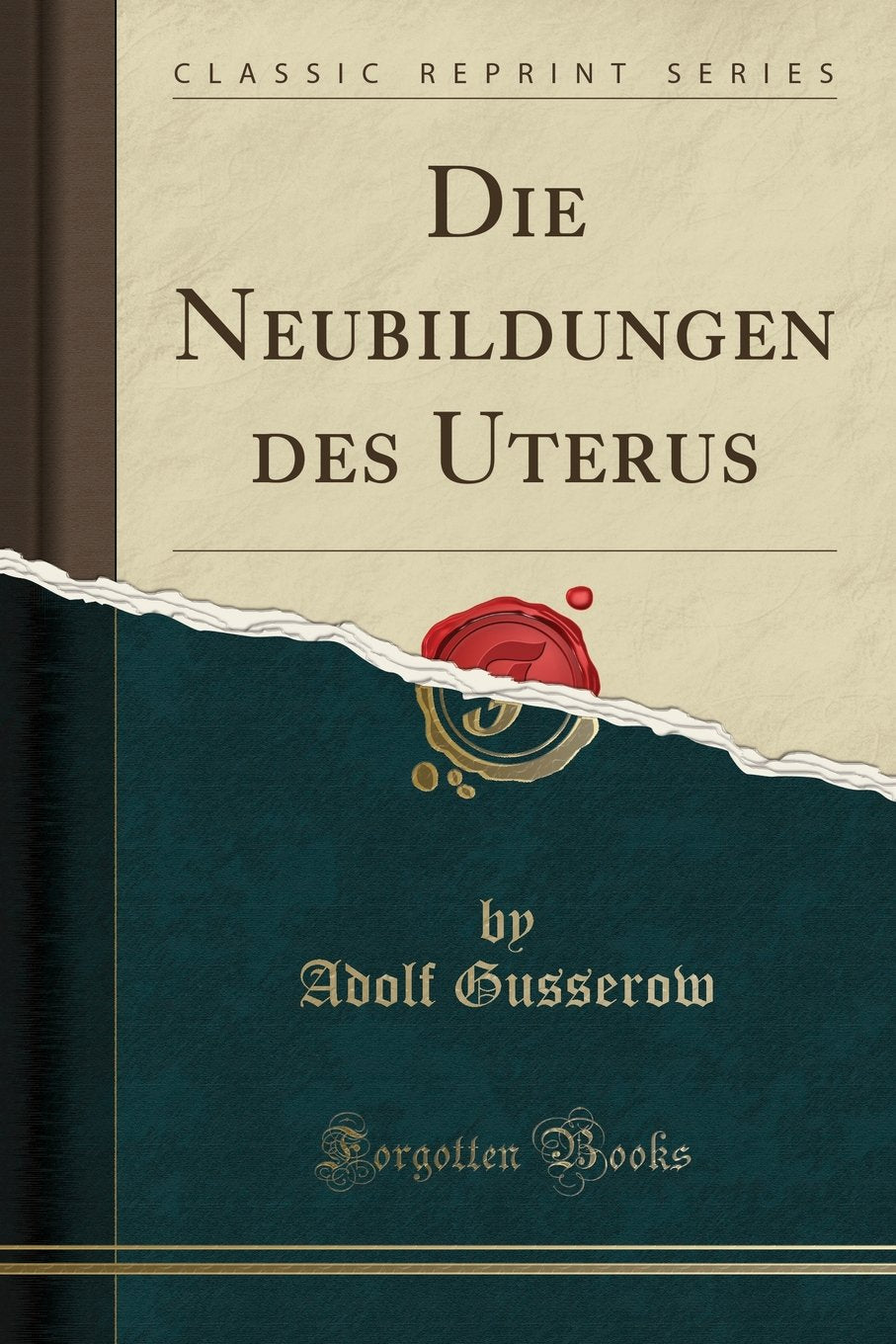 Die Neubildungen des Uterus (Classic Reprint) Medicine
