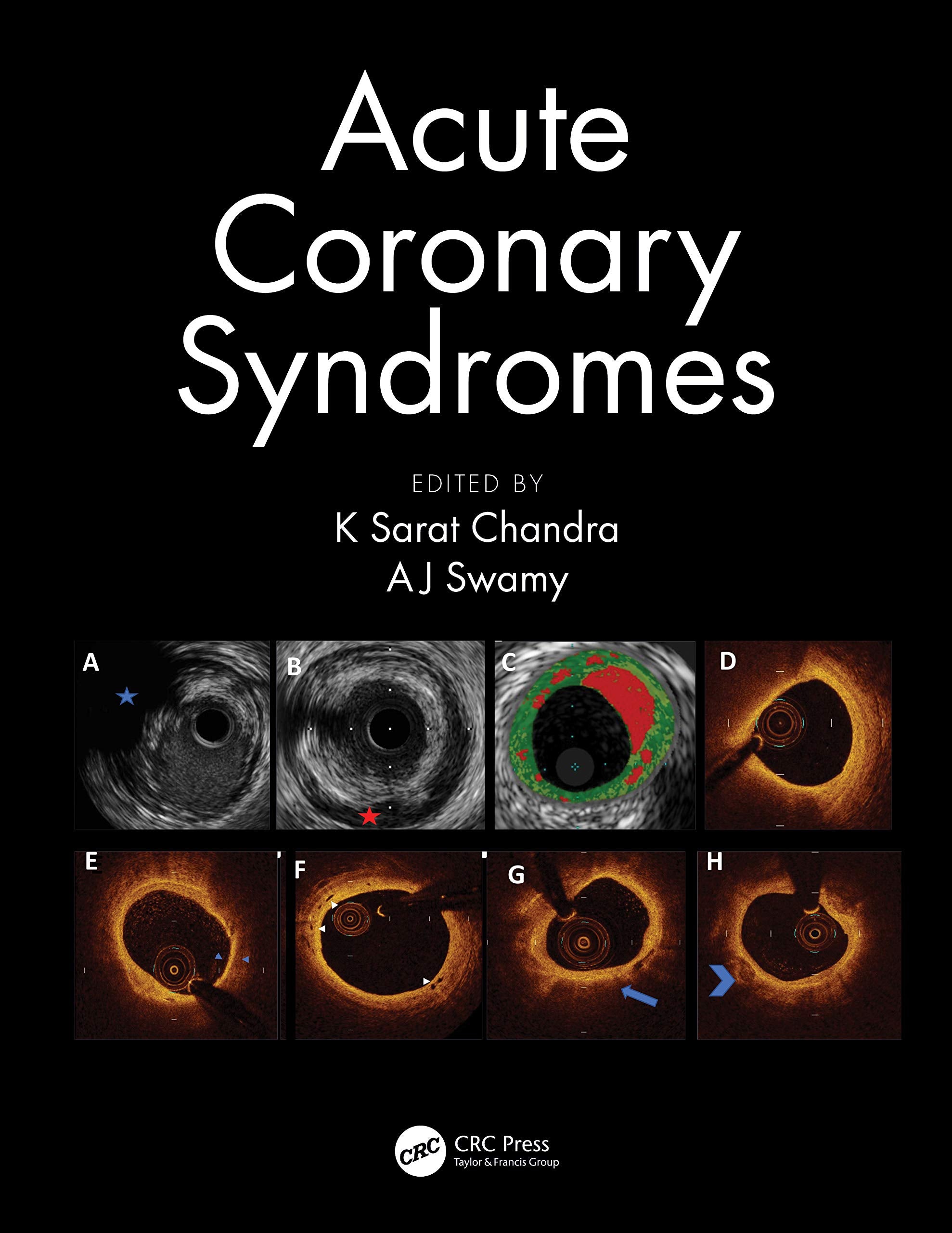 Product Image: Acute Coronary Syndromes