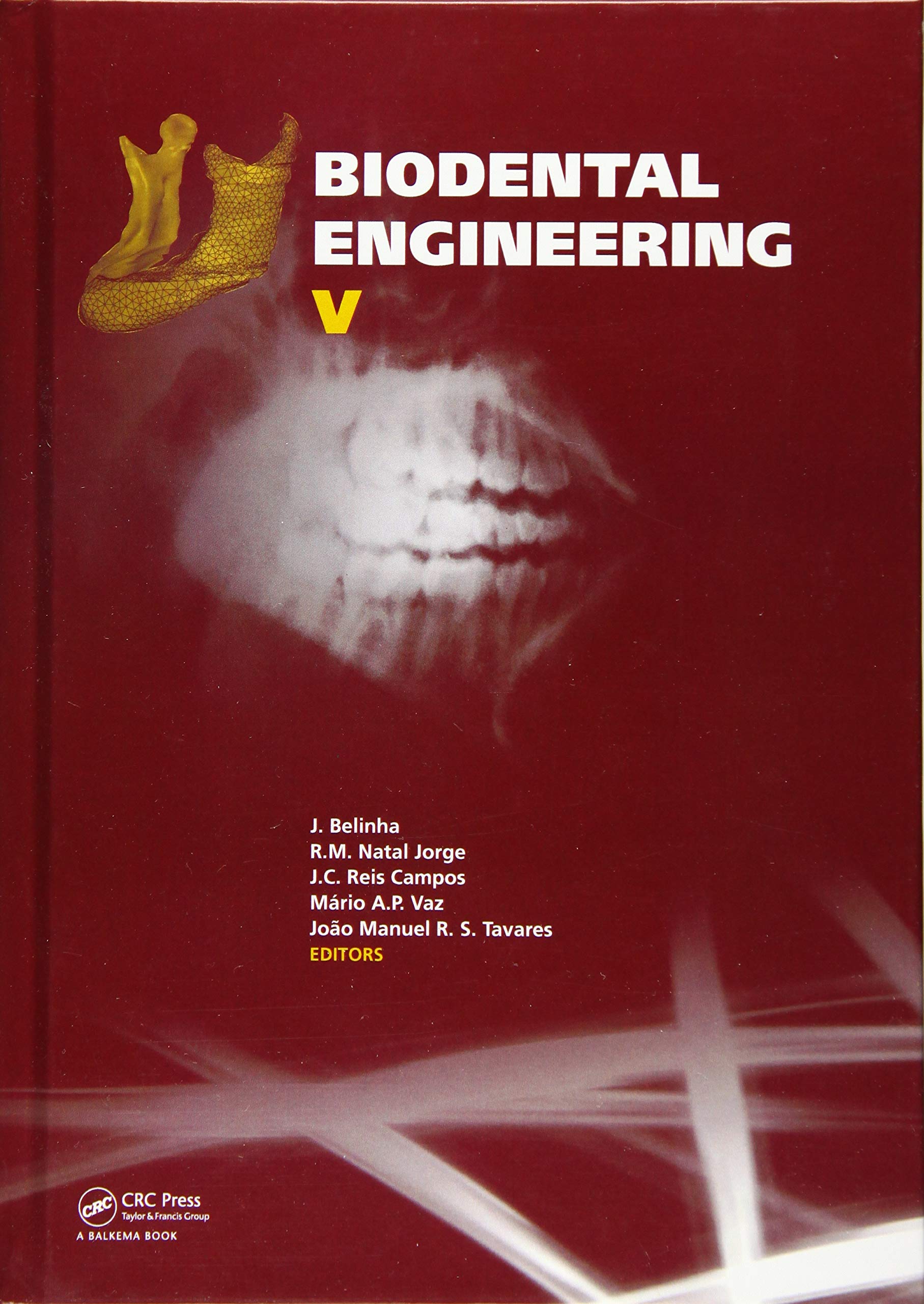 Product Image: Biodental Engineering V