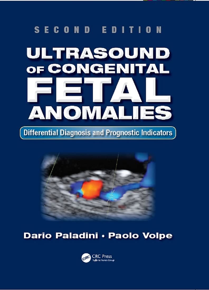 ULTRASOUND OF CONGENITAL FETAL ANOMALIES Business & Technology
