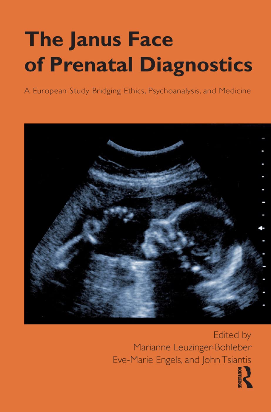 The Janus Face of Prenatal Diagnostics: A European Study Bridging Ethics, Psychoanalysis, and Medicine Medicine