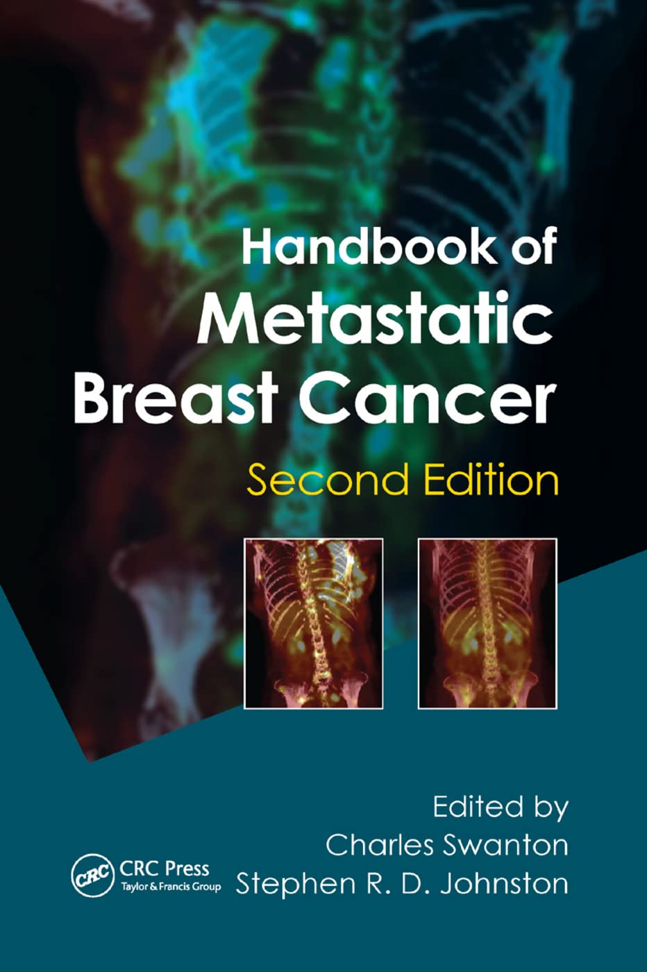 Handbook of Metastatic Breast Cancer Medicine