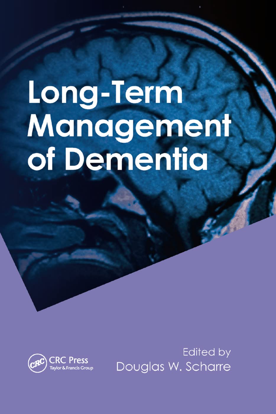 Long-Term Management of Dementia Medicine