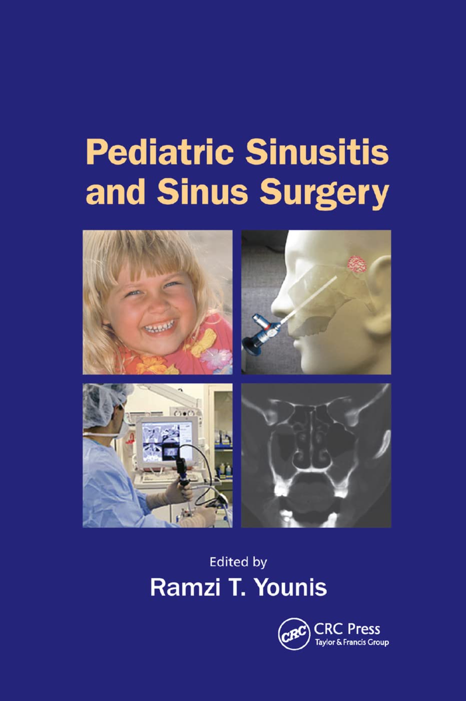 Pediatric Sinusitis and Sinus Surgery Medicine