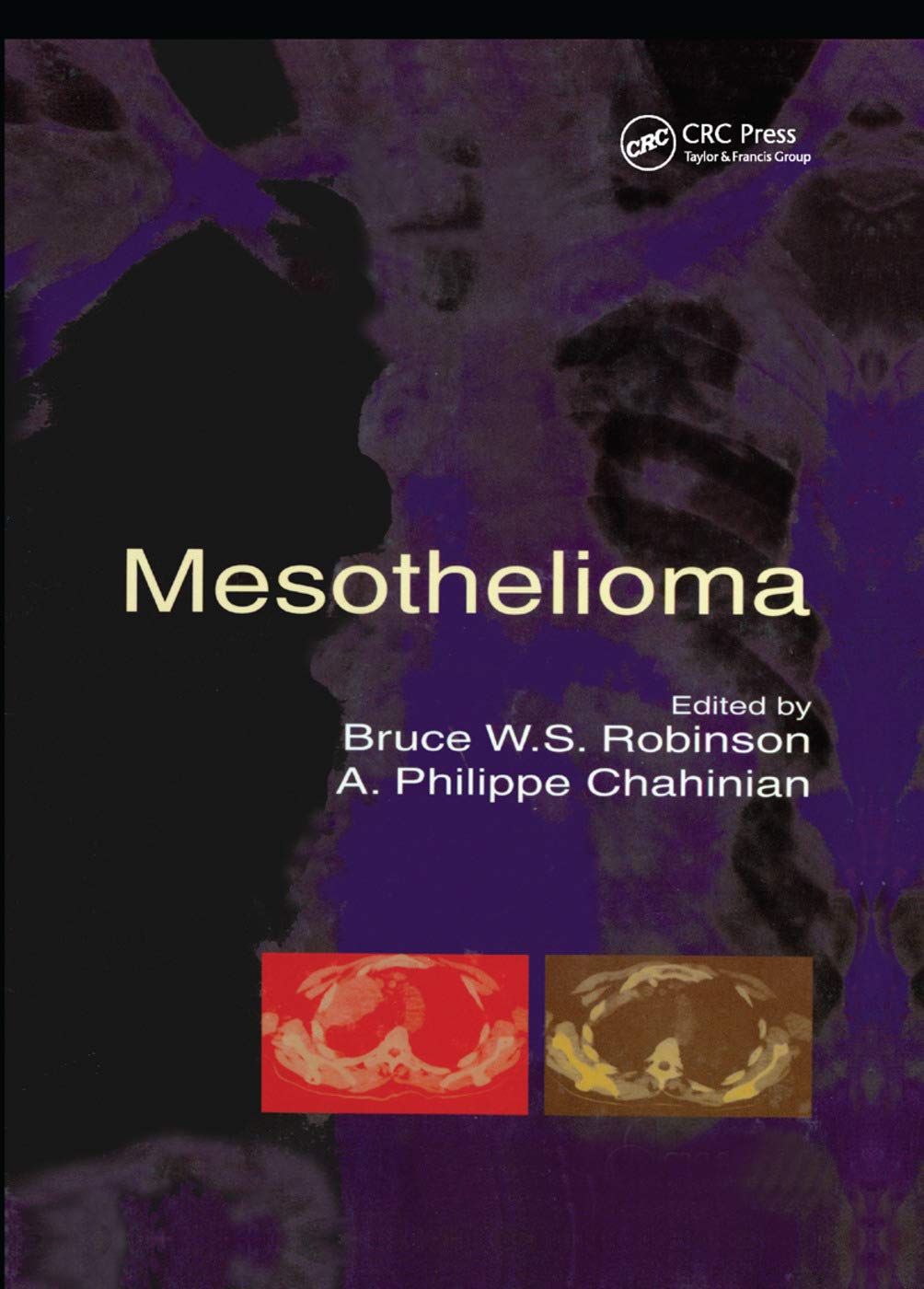 Mesothelioma Medicine Books