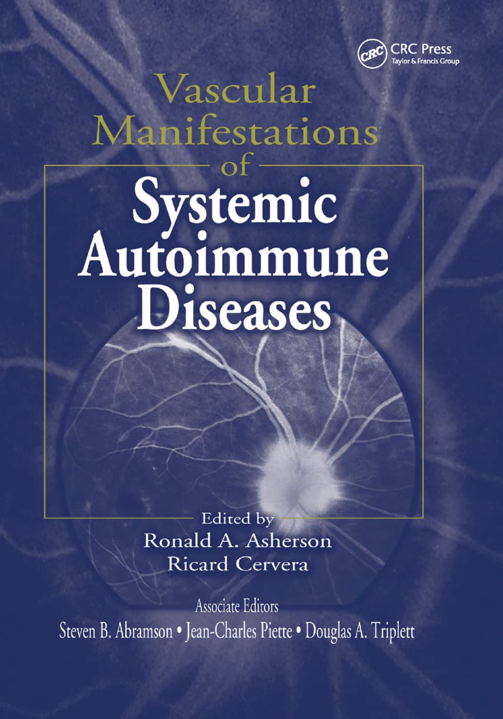 Vascular Manifestations of Systemic Autoimmune Diseases Medicine