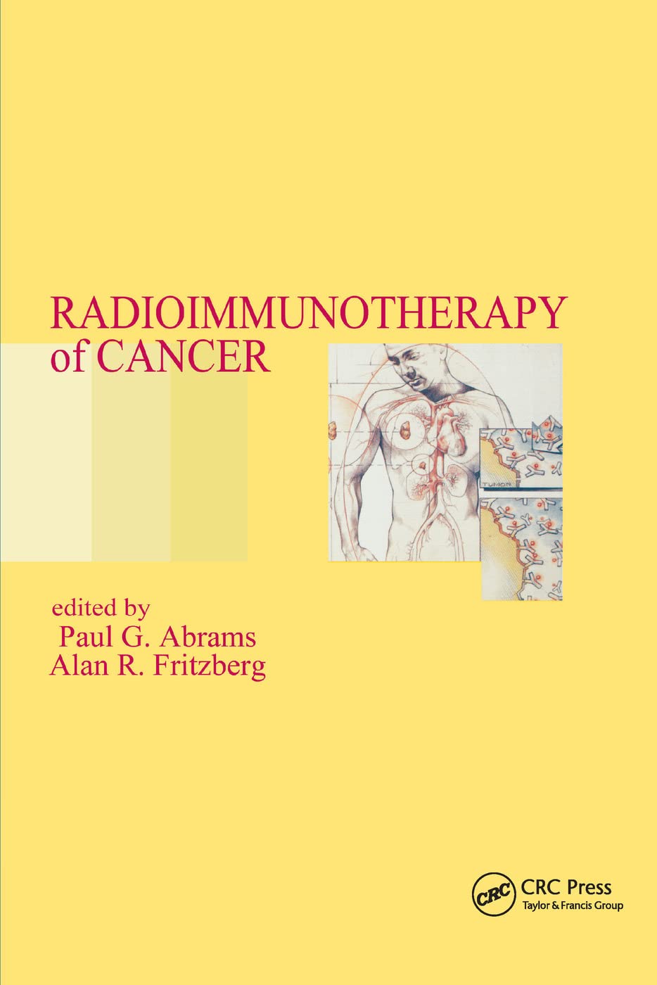 Radioimmunotherapy of Cancer Medicine