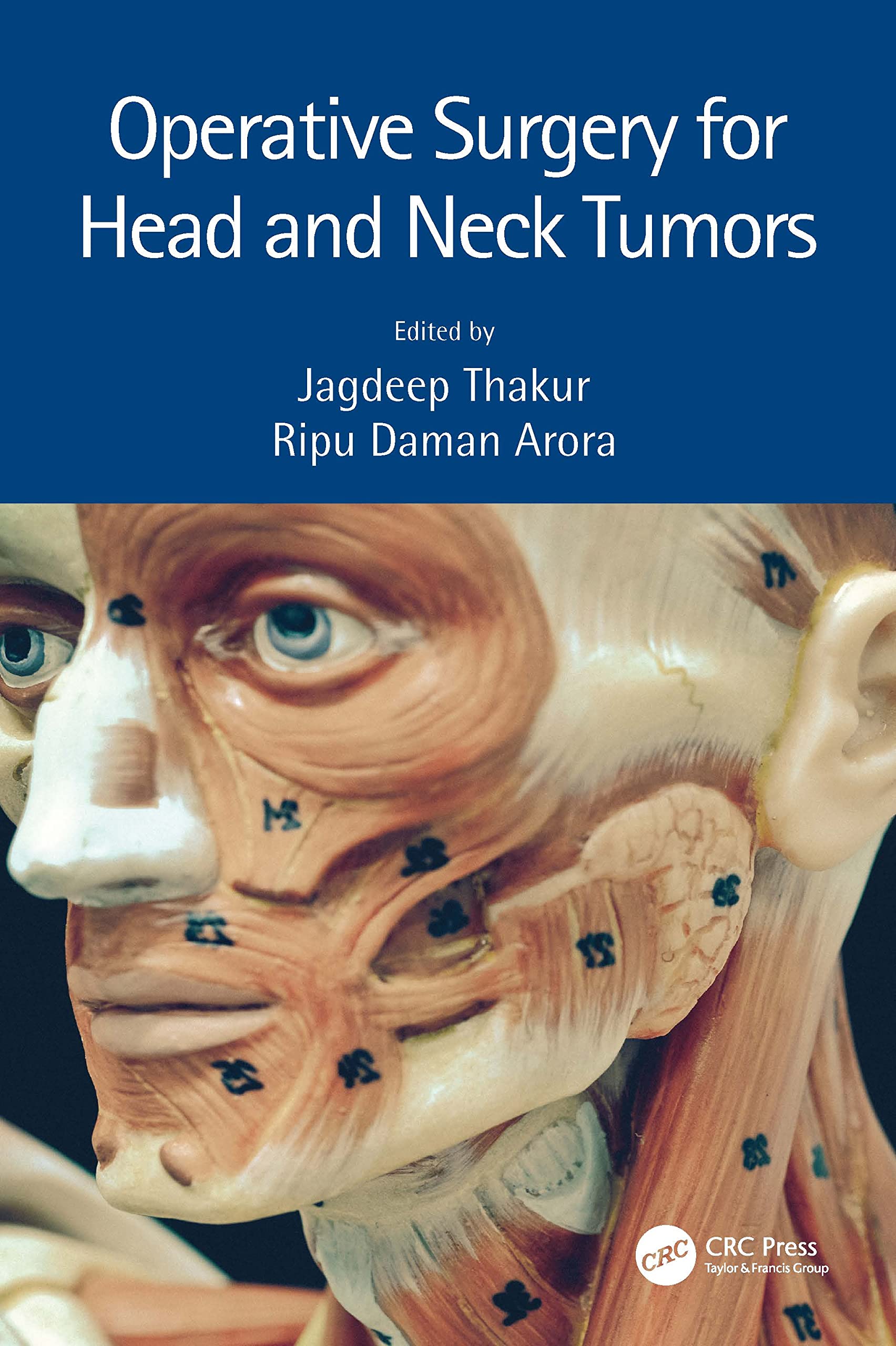 Operative Surgery for Head and Neck Tumors Medicine