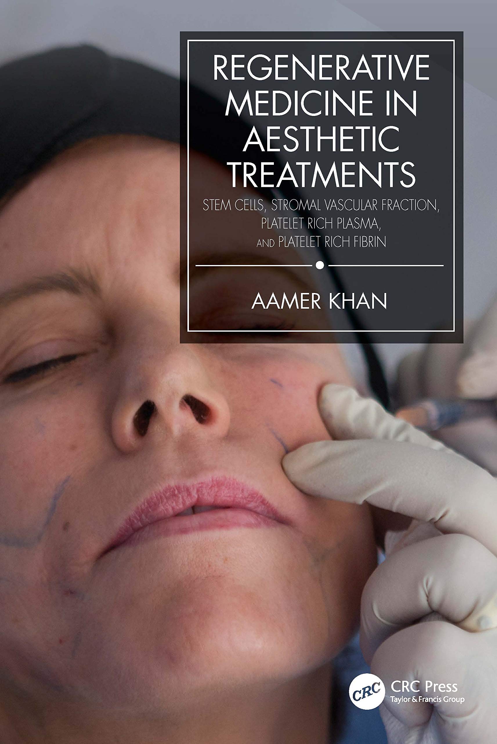 Regenerative Medicine in Aesthetic Treatments: Stem Cells, Stromal Vascular Fraction, Platelet Rich Plasma, and Platelet Rich Fibrin Medicine