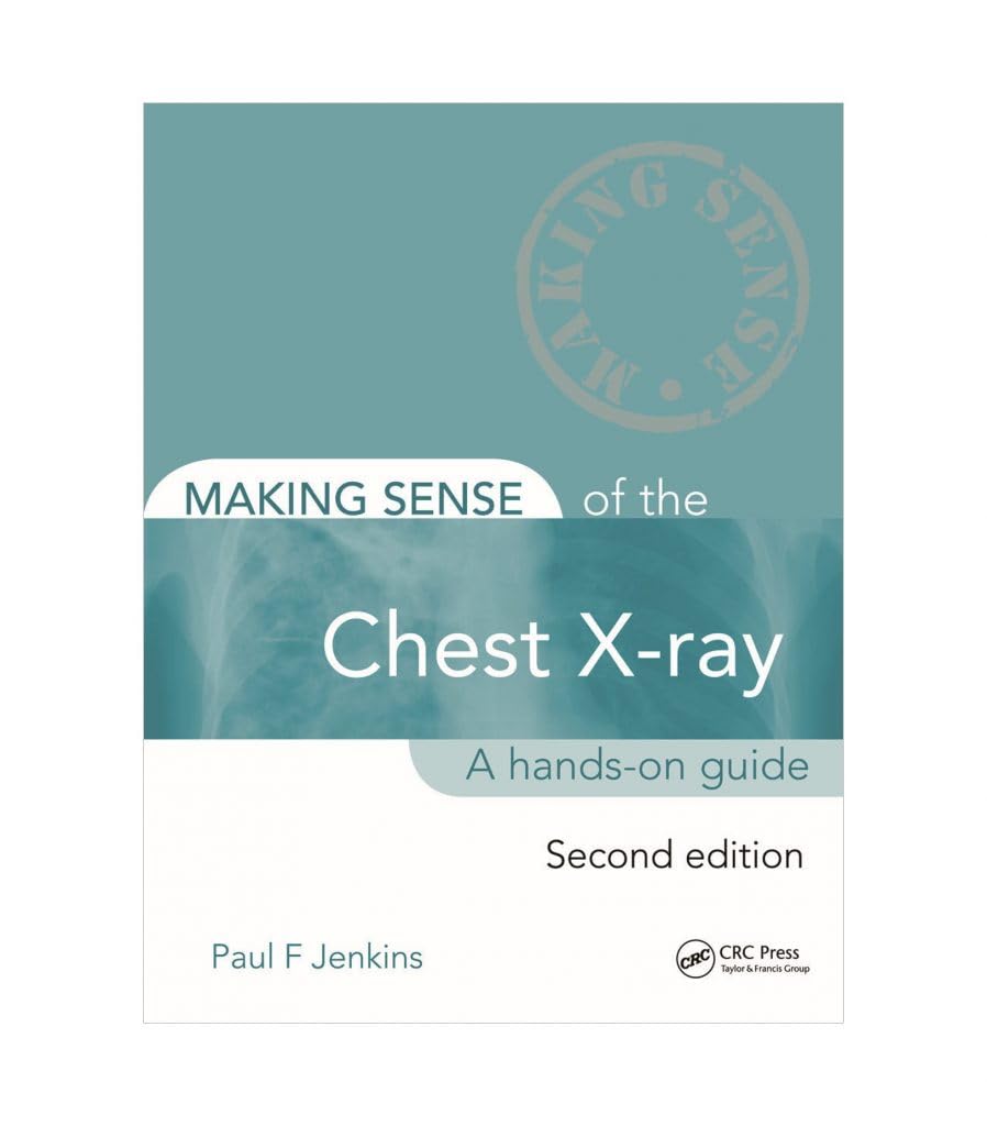 Making Sense Of The Chest X-Ray A Hands On Guide 2Ed (Pb 2020) Books