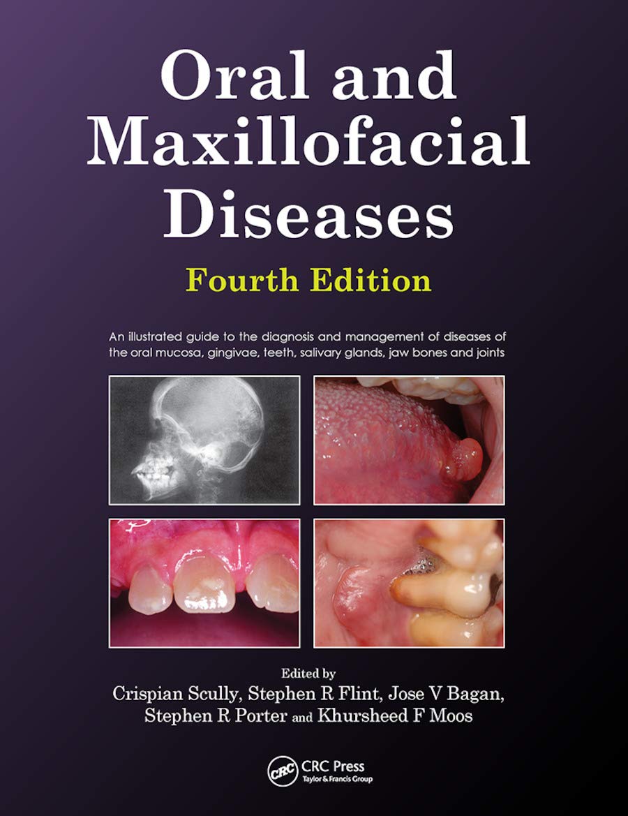Oral and Maxillofacial Diseases: An Illustrated Guide to the Diagnosis and Management of Diseases of the Oral Mucosa, Gingivae, Teeth, Salivary Glands, Jaw Bones and Joints Medicine