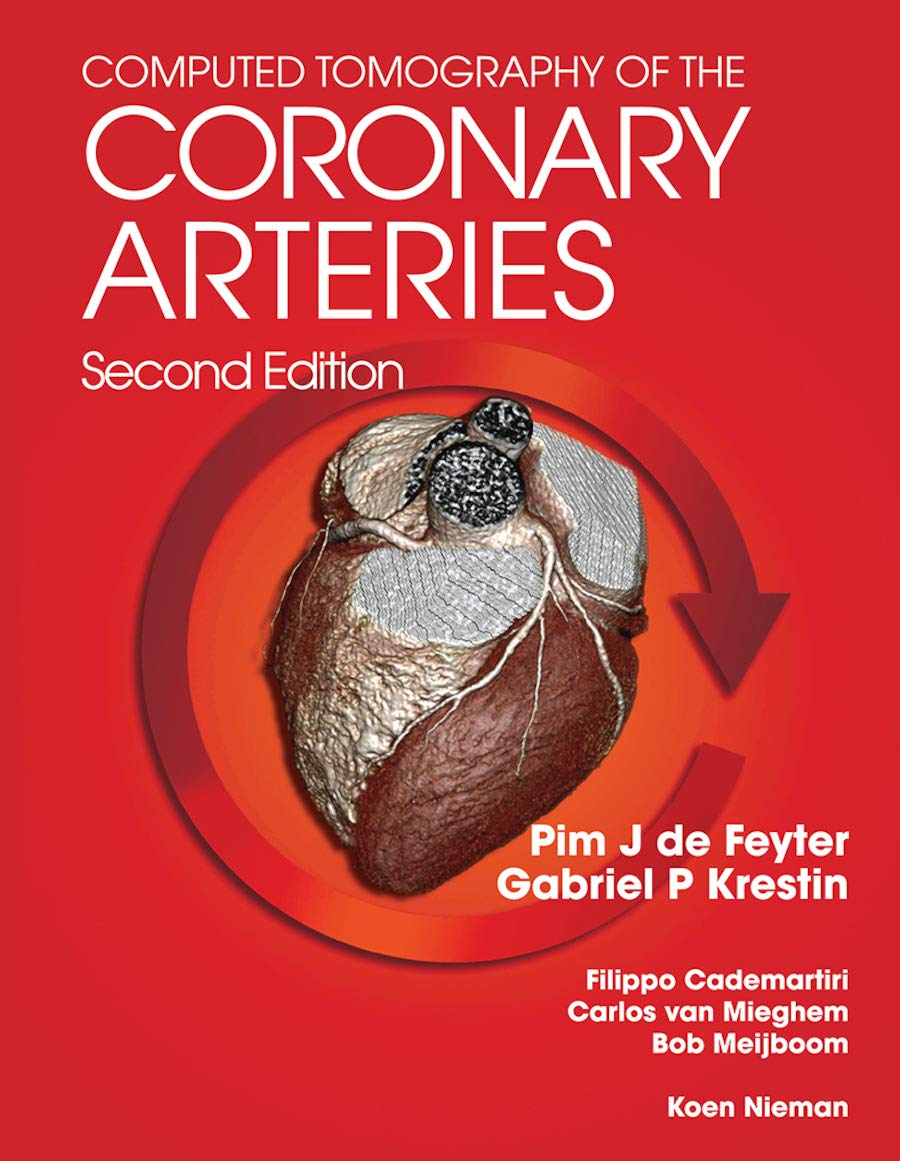 Computed Tomography of the Coronary Arteries Medicine