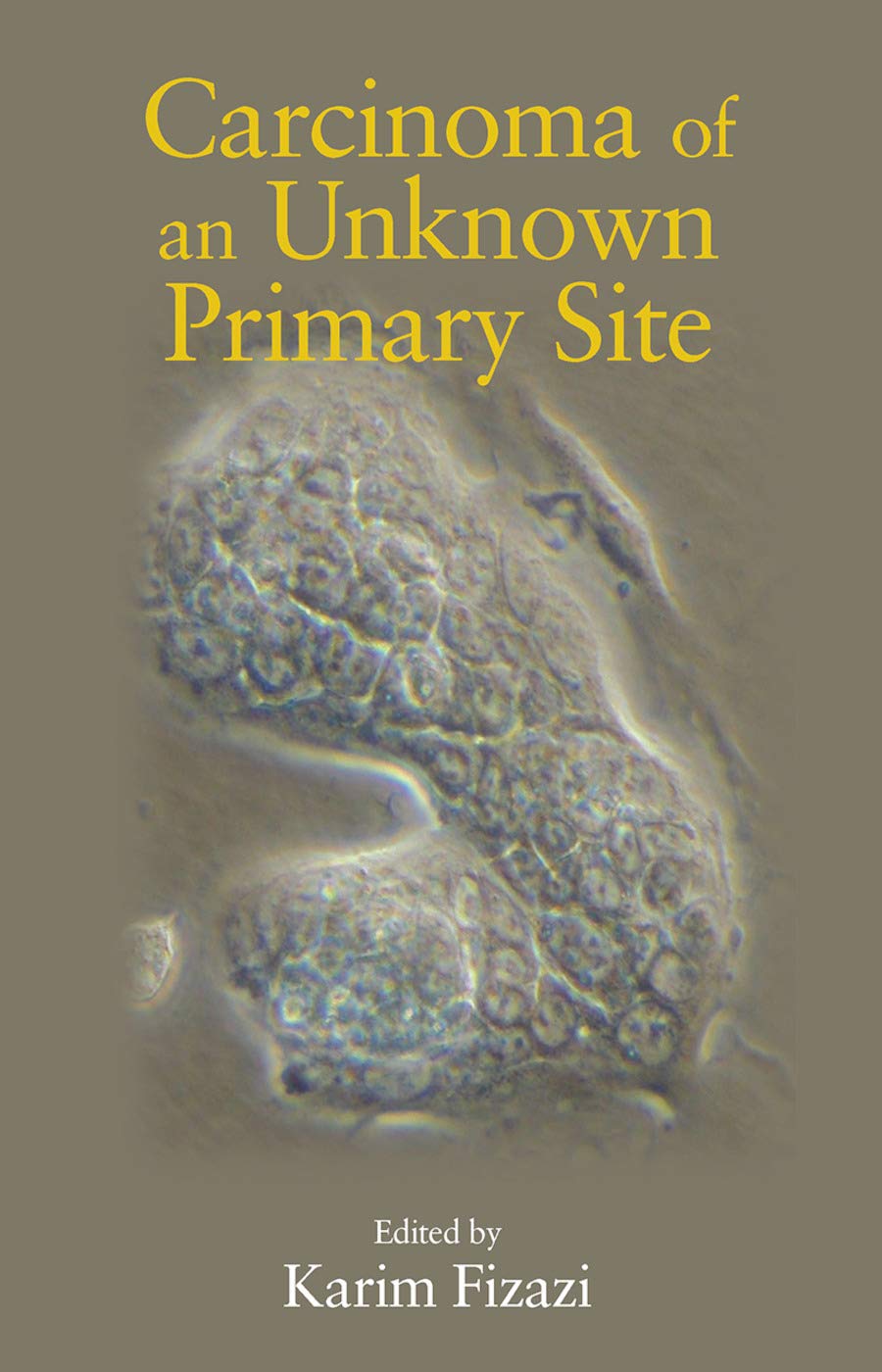 Carcinoma of an Unknown Primary Site Medicine