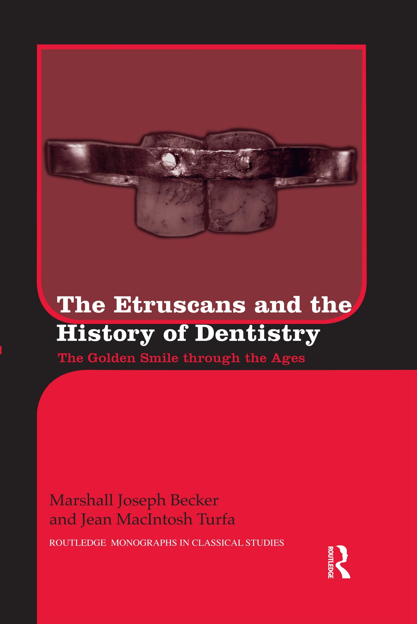 The Etruscans and the History of Dentistry book