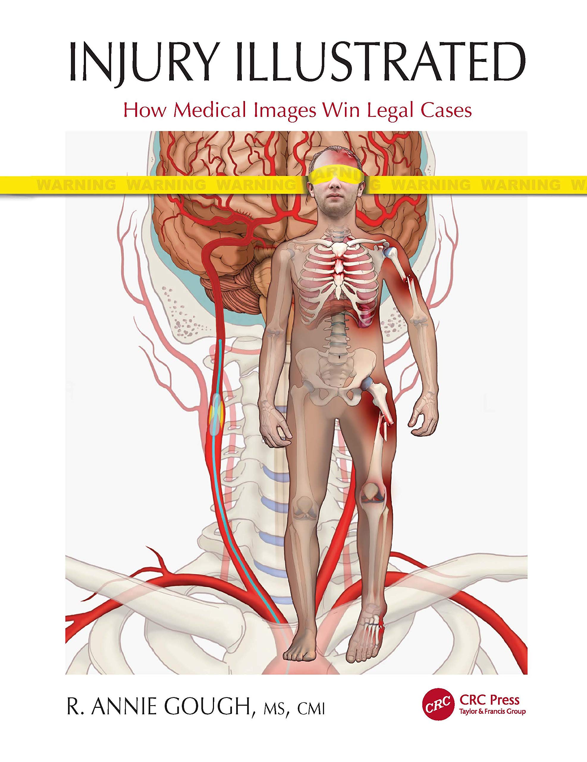 Injury Illustrated: How Medical Images Win Legal Cases Medicine