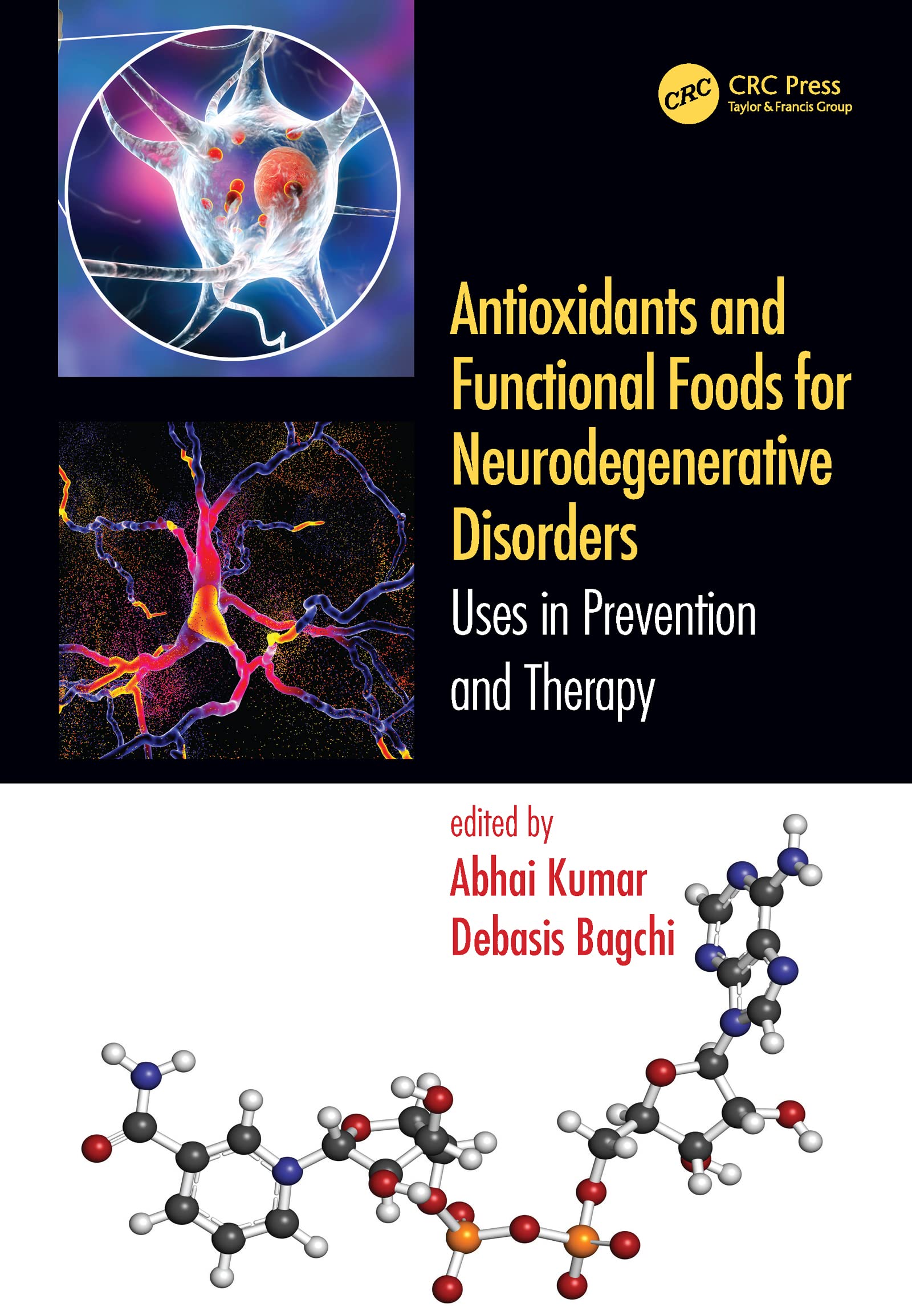 Antioxidants and Functional Foods for Neurodegenerative Disorders: Uses in Prevention and Therapy Medicine