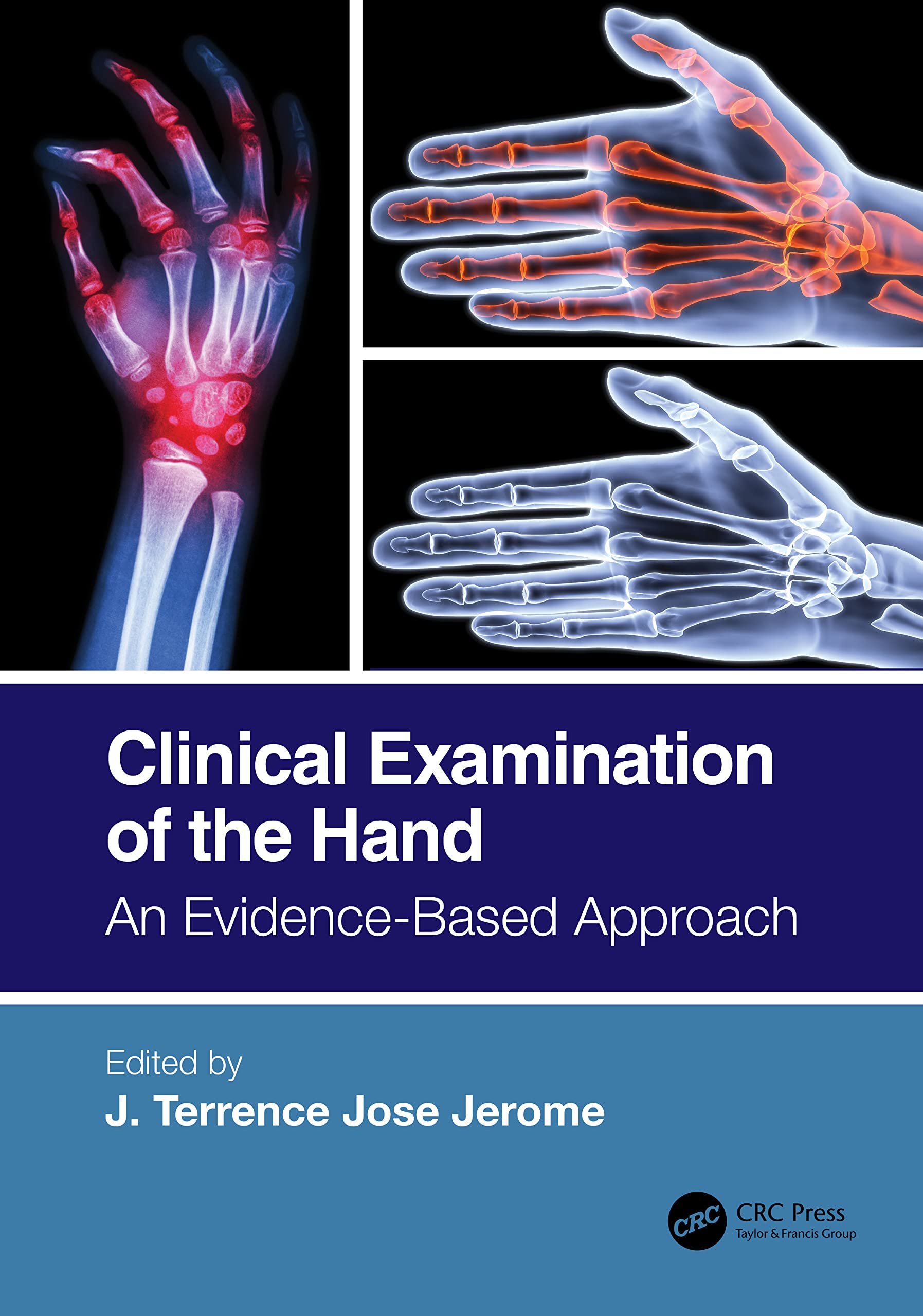 Clinical Examination of the Hand Medicine