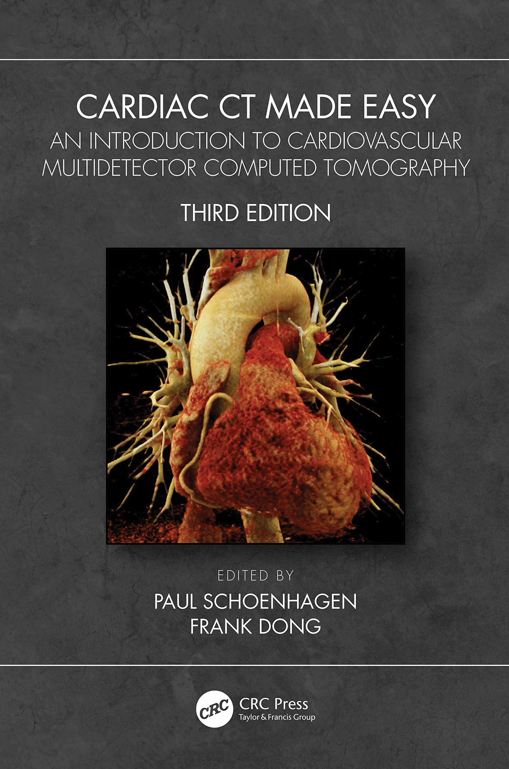 Cardiac CT Made Easy: An Introduction to Cardiovascular Multidetector Computed Tomography Medicine