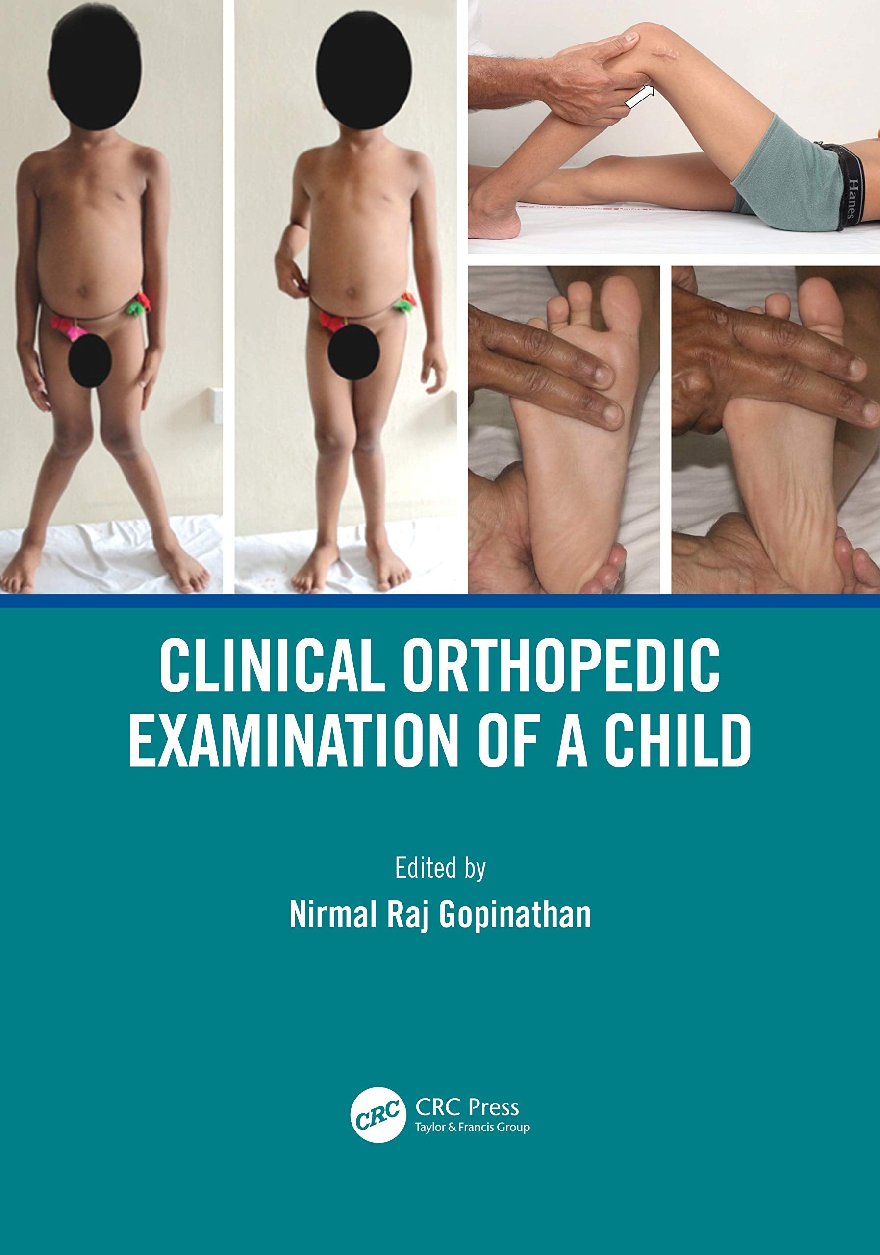 Clinical Orthopedic Examination of a Child Medicine
