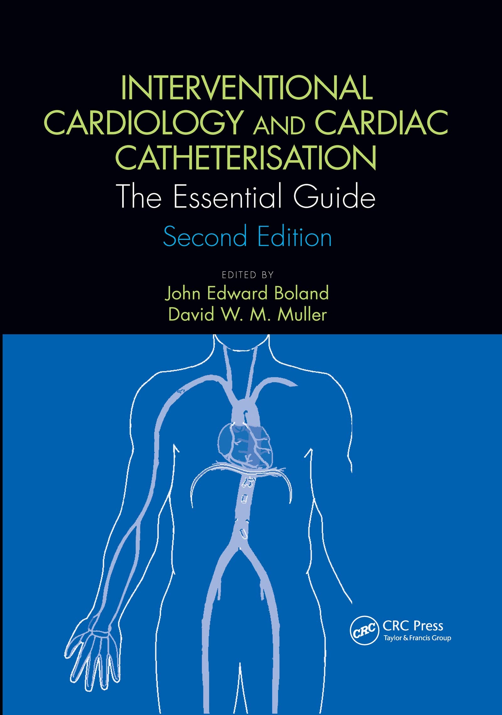 Interventional Cardiology and Cardiac Catheterisation: The Essential Guide Medicine