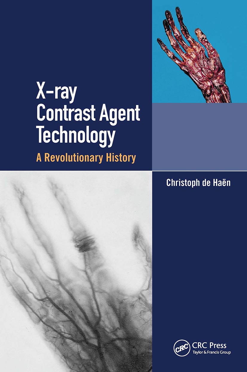 X-ray Contrast Agent Technology: A Revolutionary History Medicine