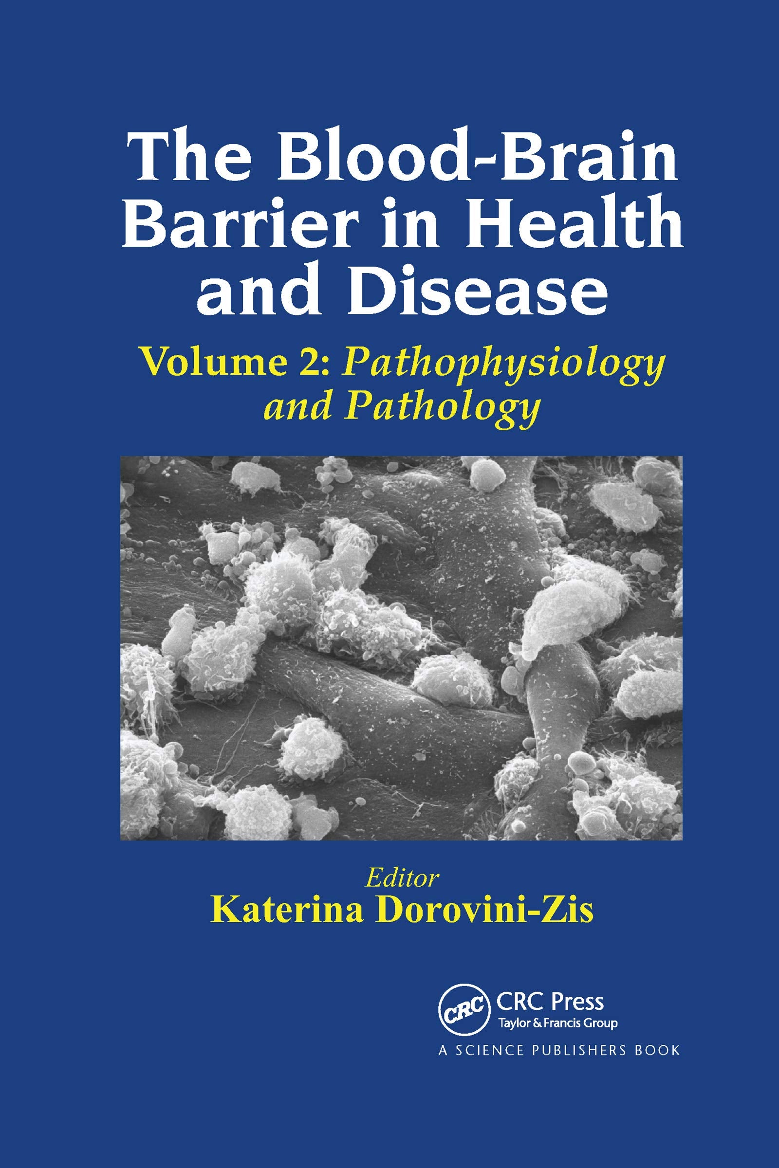 The Blood-Brain Barrier in Health and Disease, Volume Two: Pathophysiology and Pathology Medicine