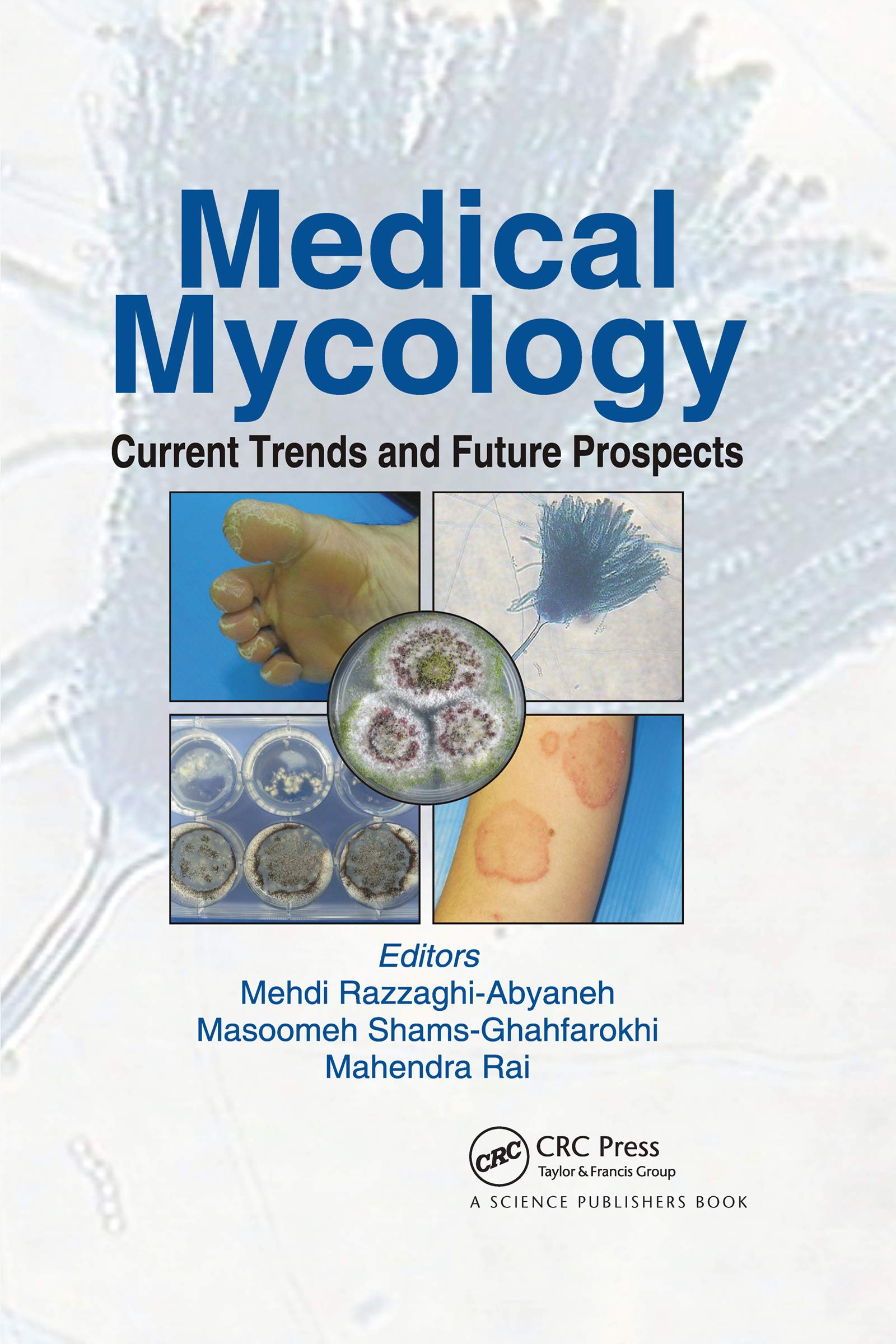 Medical Mycology: Current Trends and Future Prospects Medicine